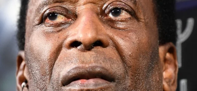 Pelé se encuentra en un delicado estado de salud / AFP