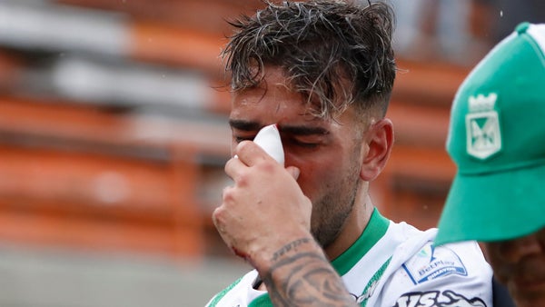 Facundo Batista sufrió fractura de tabique en la victoria de Nacional