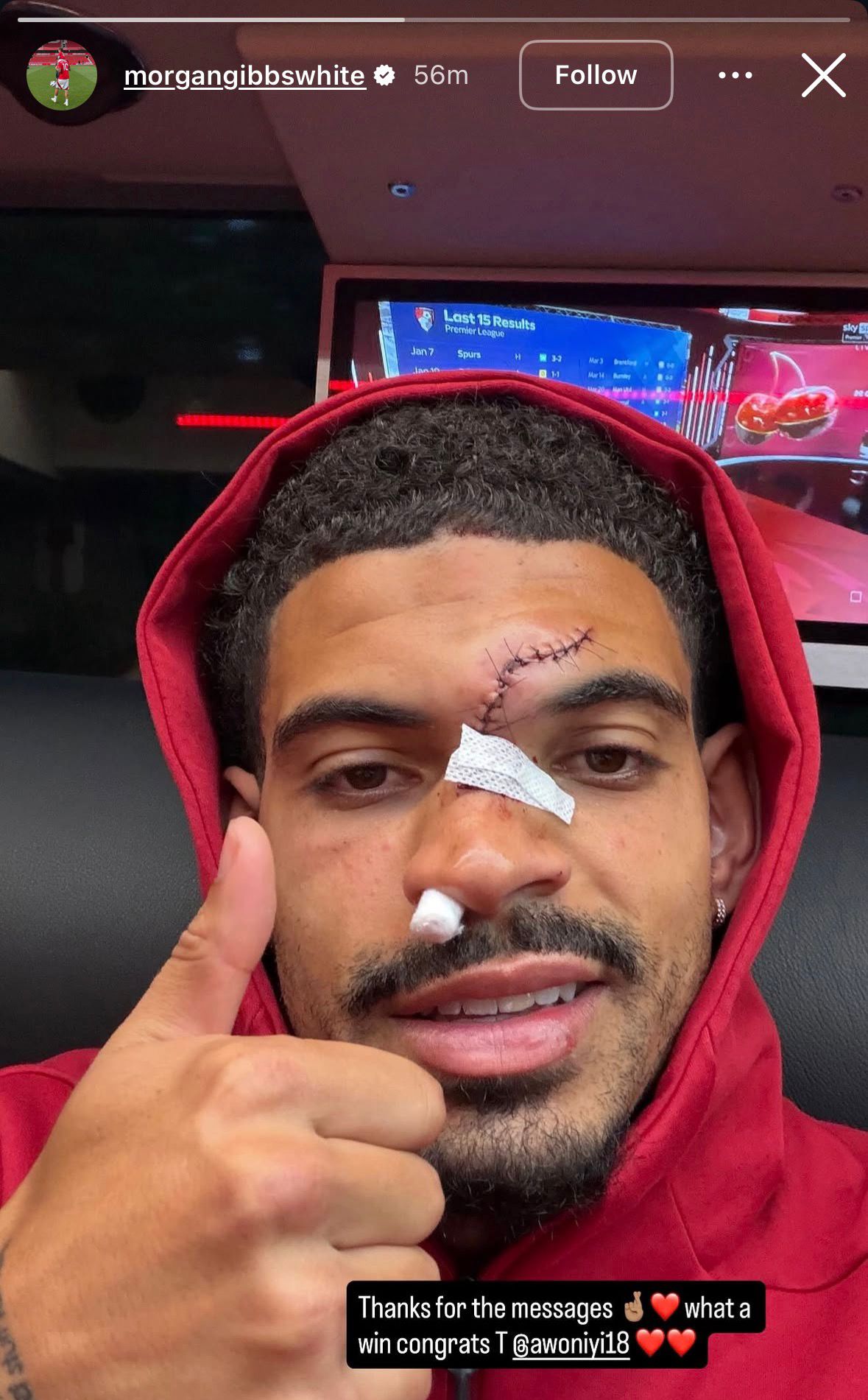 Morgan Gibbs-White publicó una fotografía sobre cómo terminó tras ser atendido por su lesión en el rostro - Instagram